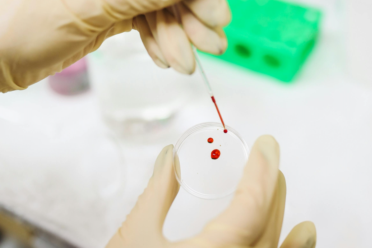 blood-test-lyme-disease-saunace blood-test-lyme-disease-saunace