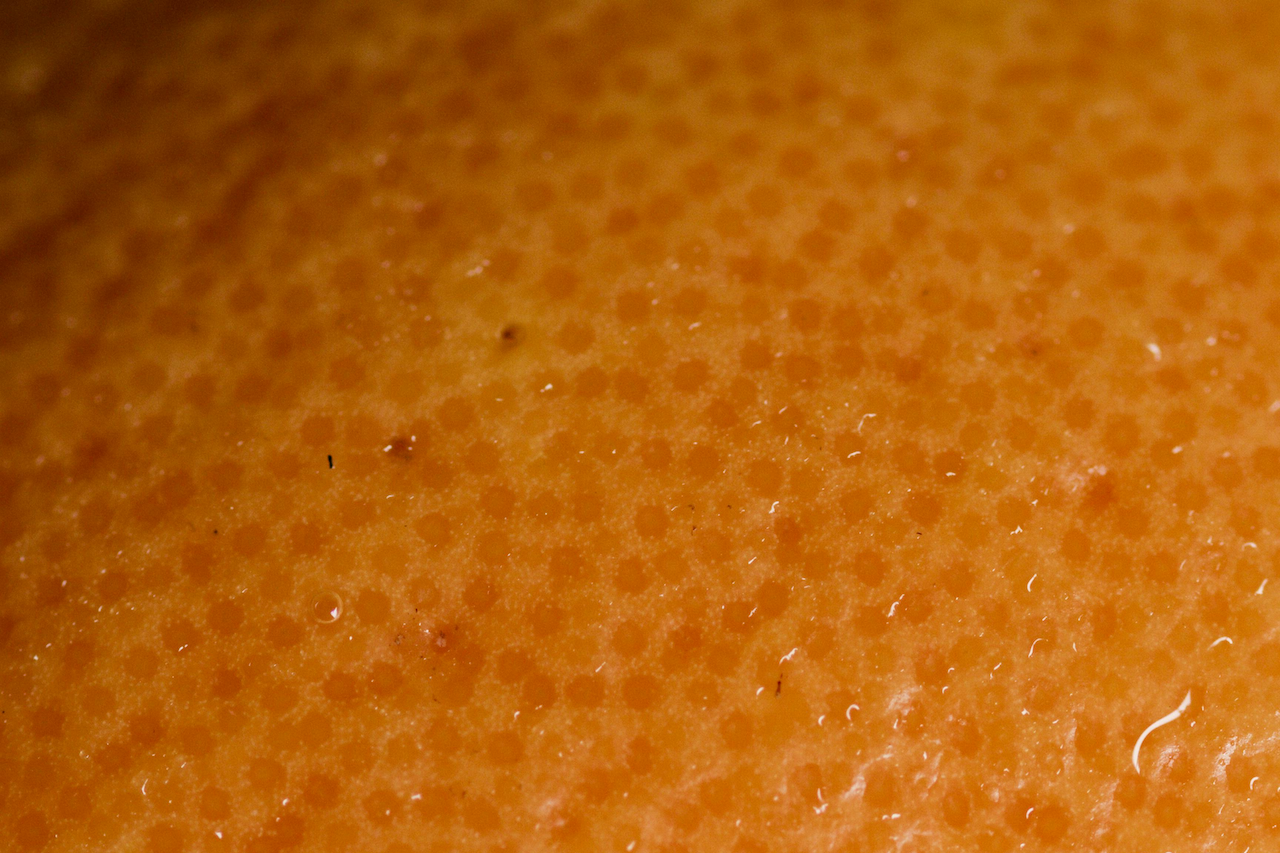 cellulite-orange-peel-texture cellulite-orange-peel-texture